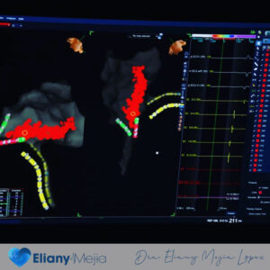 Electrofisiología Cardiaca - 002 - Eliany Mejia